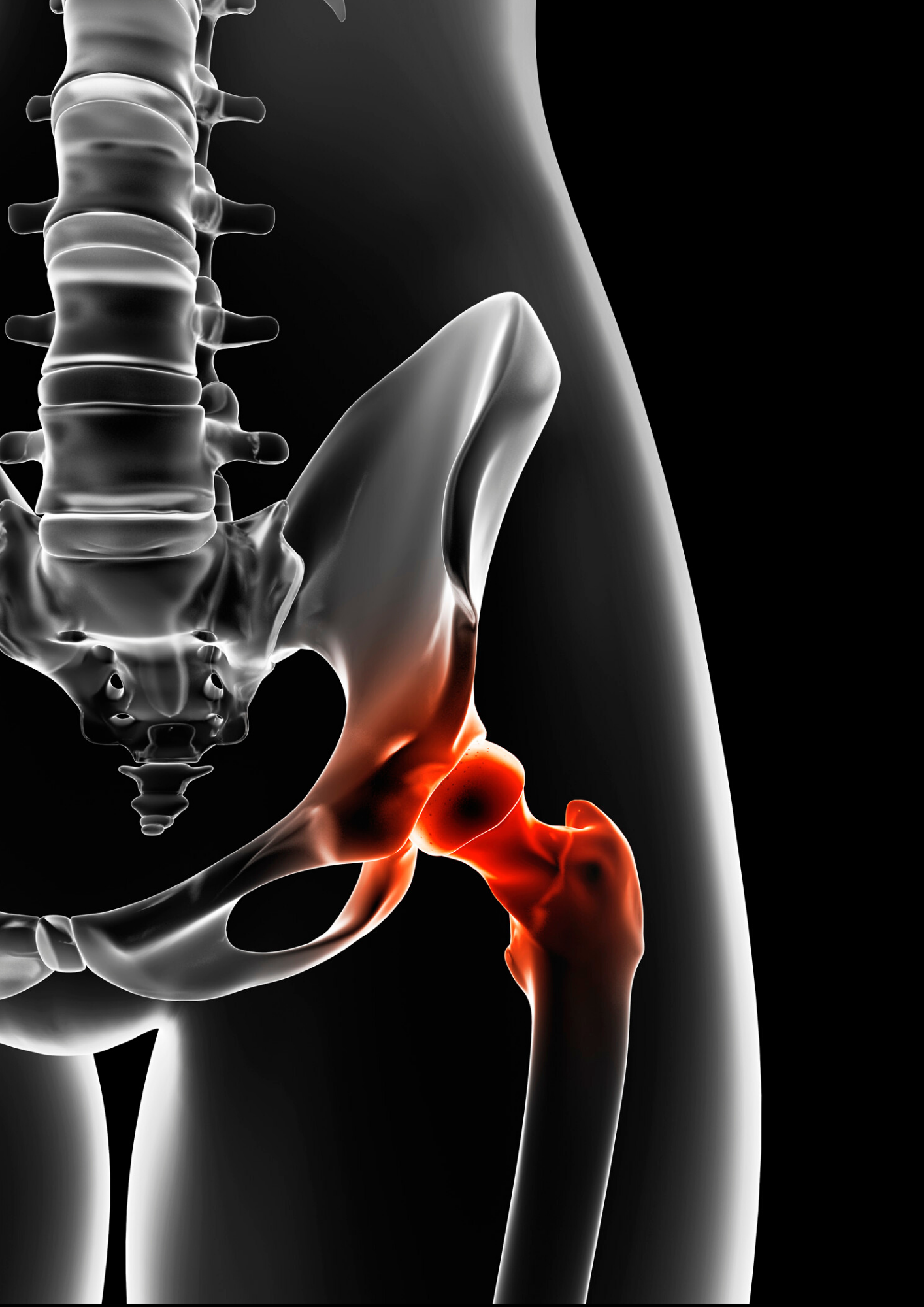Bein Hueften Schmerzen