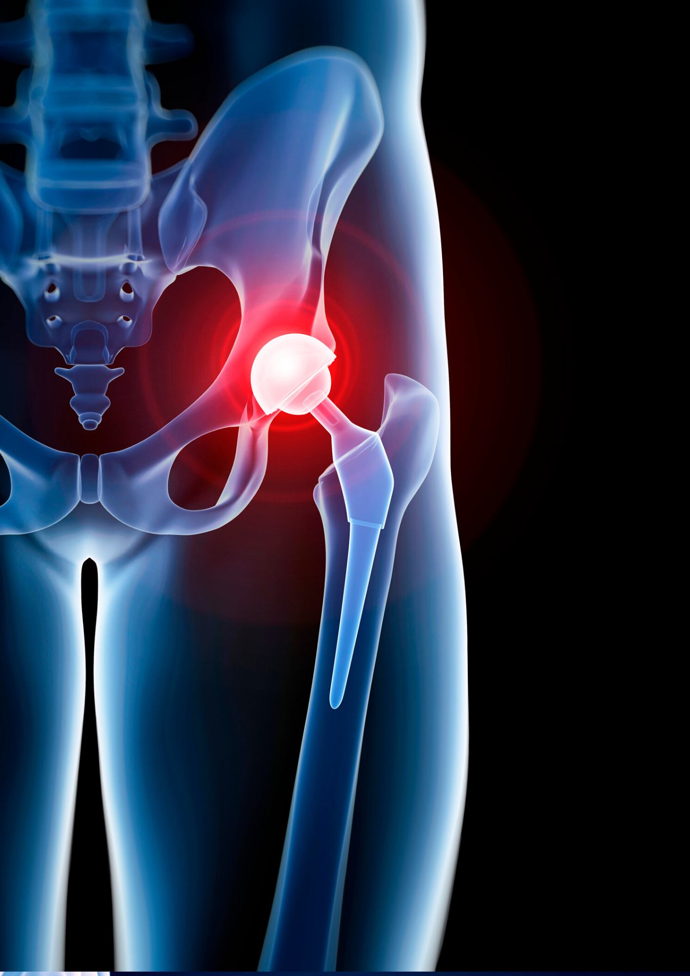 Services Hueftenschmerzen2